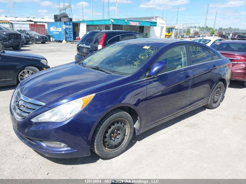 2011 Hyundai Sonata Gls VIN: 5NPEB4AC5BH175527 Lot: 12013884