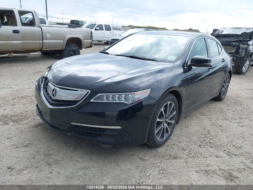 2015 Acura Tlx VIN: 19UUB3F51FA800729 Lot: 12014226