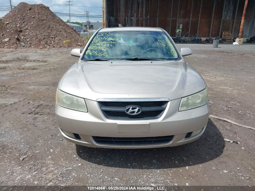 5NPET46C77H295231 2007 Hyundai Sonata Gls