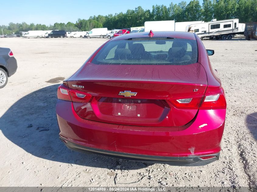 2018 Chevrolet Malibu VIN: 1G1ZD5ST2JF139134 Lot: 12014889