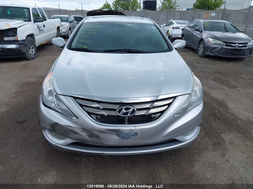 2013 Hyundai Sonata Gls VIN: 5NPEB4ACXDH792070 Lot: 12015090