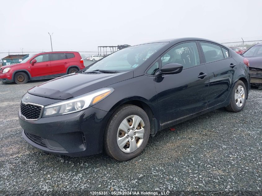 2017 Kia Forte VIN: 3KPFK4A77HE034379 Lot: 12015331