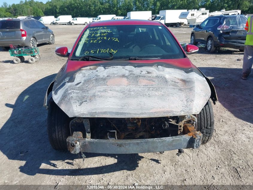 2020 Kia Forte VIN: 3KPF54ADXLE218172 Lot: 12015346