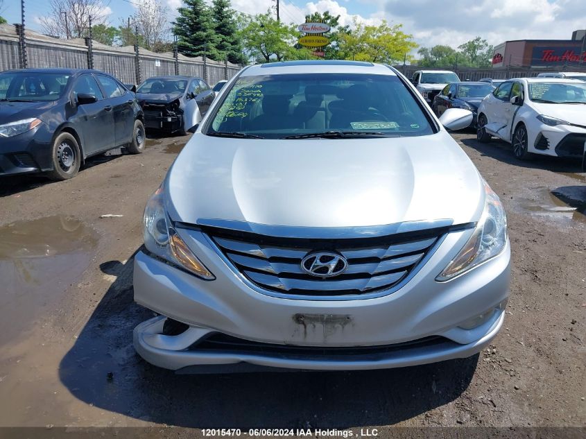 2012 Hyundai Sonata VIN: 5NPEB4AC6CH336498 Lot: 12015470