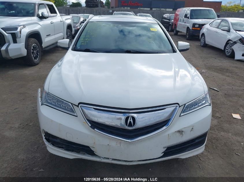 2015 Acura Tlx VIN: 19UUB3F53FA800635 Lot: 12015635