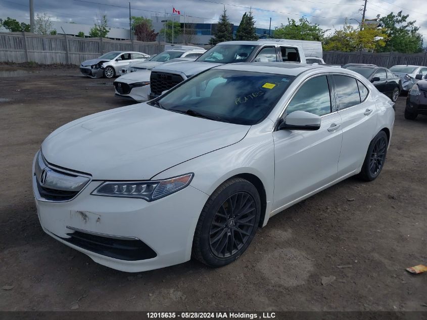 2015 Acura Tlx VIN: 19UUB3F53FA800635 Lot: 12015635