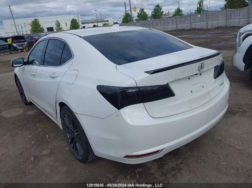 2015 Acura Tlx VIN: 19UUB3F53FA800635 Lot: 12015635