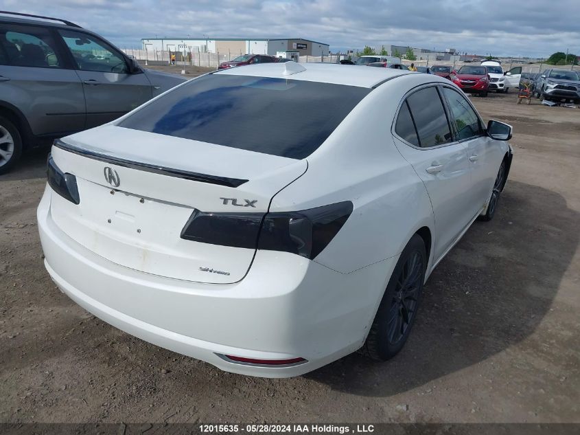 2015 Acura Tlx VIN: 19UUB3F53FA800635 Lot: 12015635