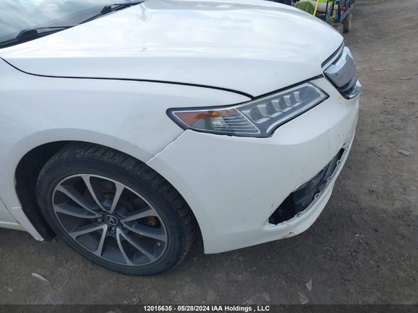 2015 Acura Tlx VIN: 19UUB3F53FA800635 Lot: 12015635