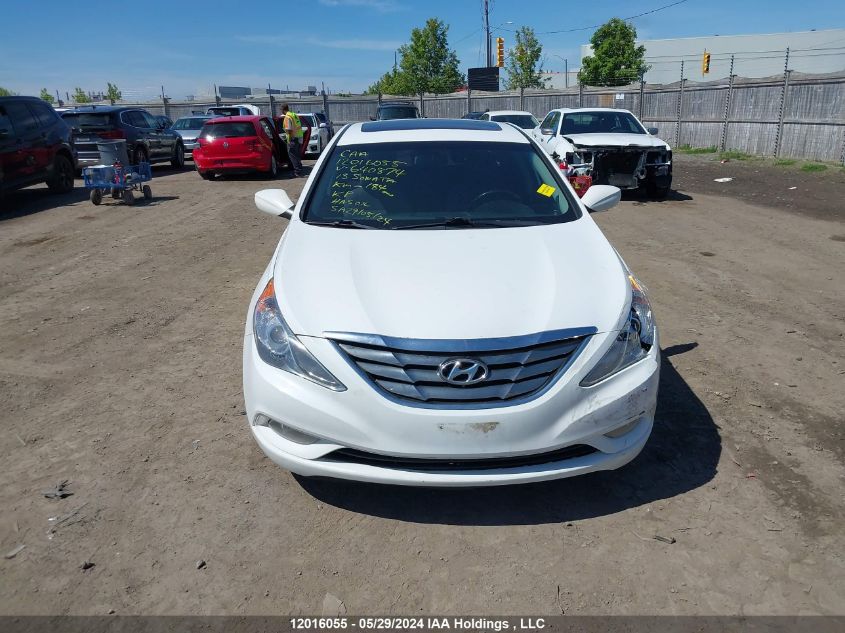 2013 Hyundai Sonata Gls VIN: 5NPEB4AC3DH640874 Lot: 12016055