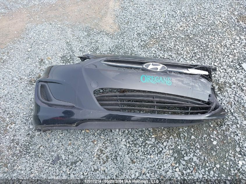 2016 Hyundai Accent Se VIN: KMHCT4AE5GU954246 Lot: 12017214