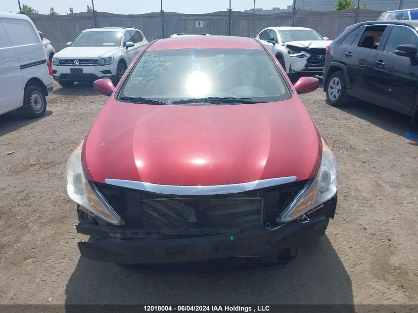 2013 Hyundai Sonata Gls VIN: 5NPEB4AC6DH732531 Lot: 12018004