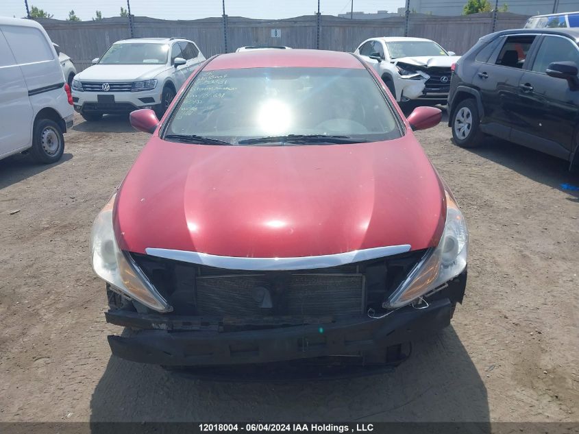 2013 Hyundai Sonata Gls VIN: 5NPEB4AC6DH732531 Lot: 12018004