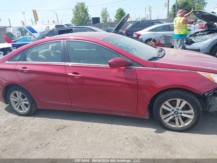 2013 Hyundai Sonata Gls VIN: 5NPEB4AC6DH732531 Lot: 12018004