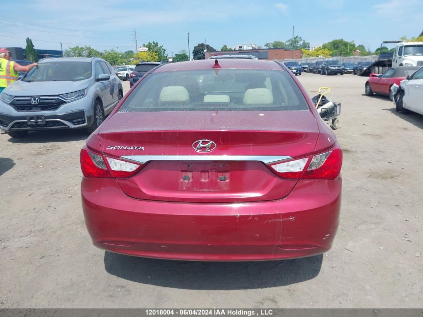 2013 Hyundai Sonata Gls VIN: 5NPEB4AC6DH732531 Lot: 12018004