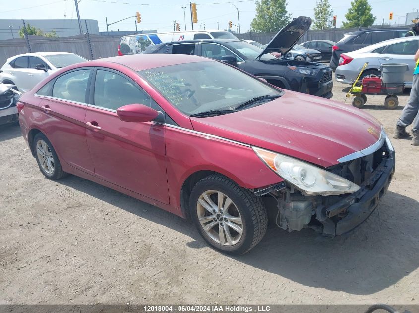 2013 Hyundai Sonata Gls VIN: 5NPEB4AC6DH732531 Lot: 12018004