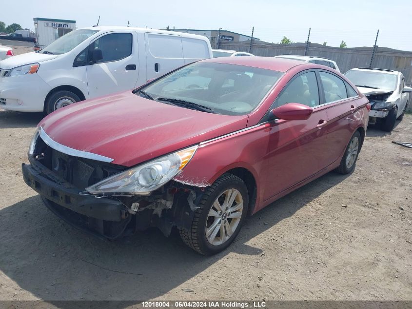 2013 Hyundai Sonata Gls VIN: 5NPEB4AC6DH732531 Lot: 12018004