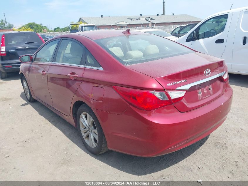 2013 Hyundai Sonata Gls VIN: 5NPEB4AC6DH732531 Lot: 12018004