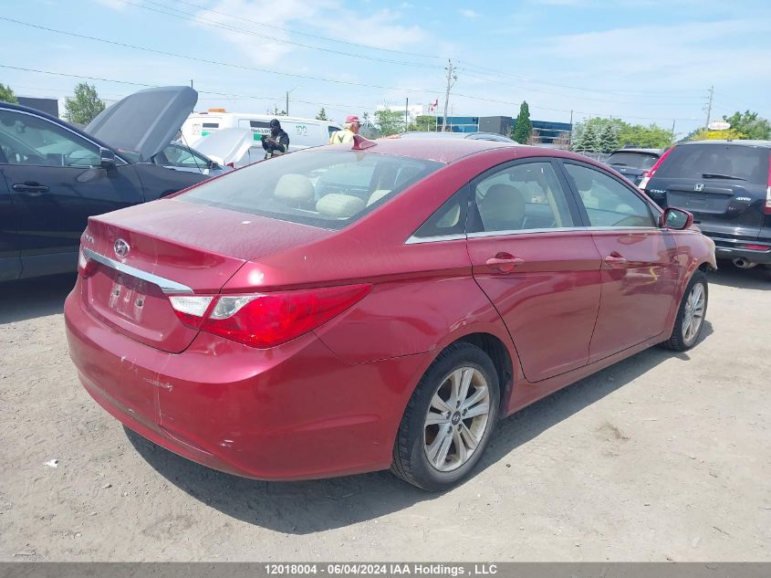 2013 Hyundai Sonata Gls VIN: 5NPEB4AC6DH732531 Lot: 12018004