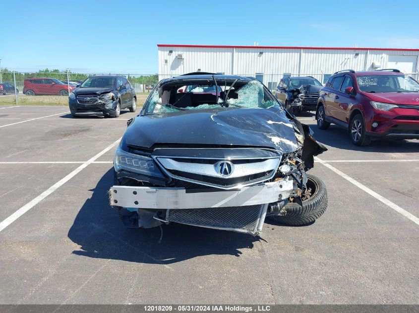 2017 Acura Ilx VIN: 19UDE2F87HA800832 Lot: 12018209