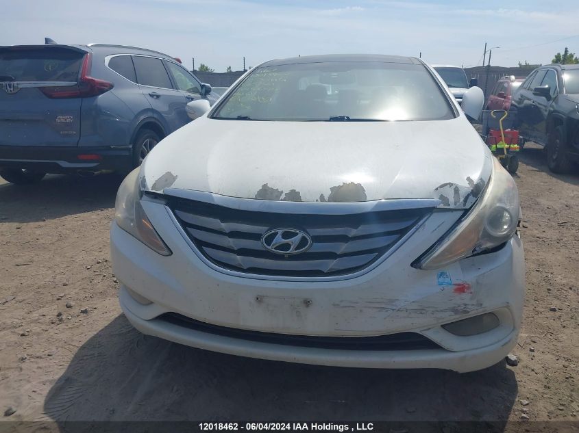 2012 Hyundai Sonata VIN: 5NPEC4AB3CH357510 Lot: 12018462