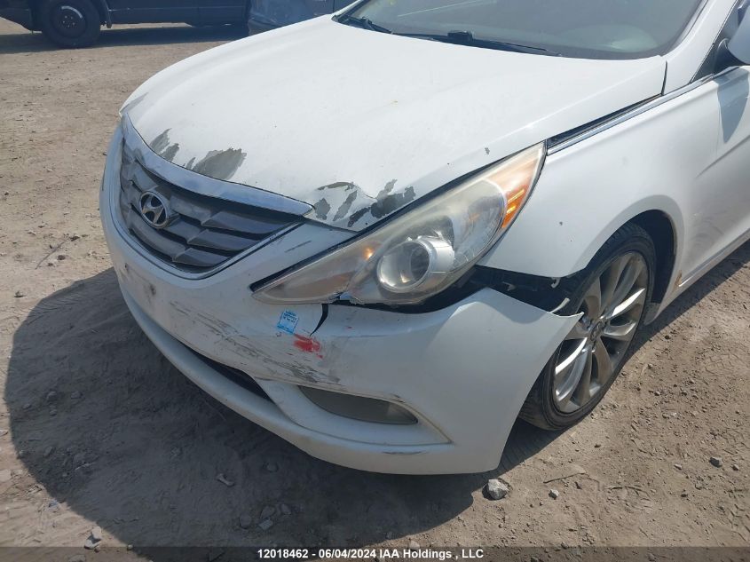 2012 Hyundai Sonata VIN: 5NPEC4AB3CH357510 Lot: 12018462