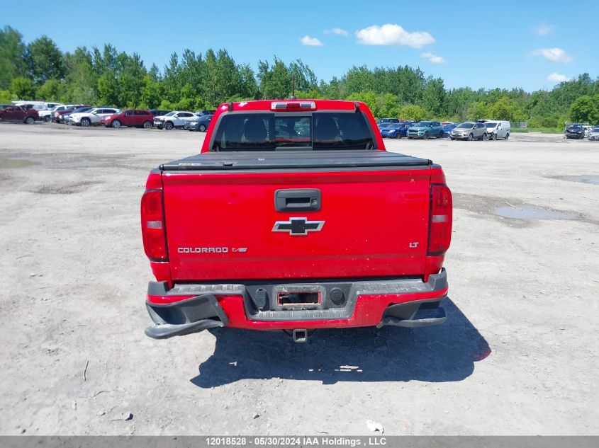 2018 Chevrolet Colorado VIN: 1GCGTCEN0J1145823 Lot: 12018528