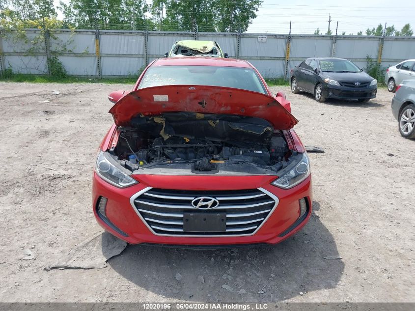 2017 Hyundai Elantra Se/Value/Limited VIN: KMHD84LF6HU389891 Lot: 12020196