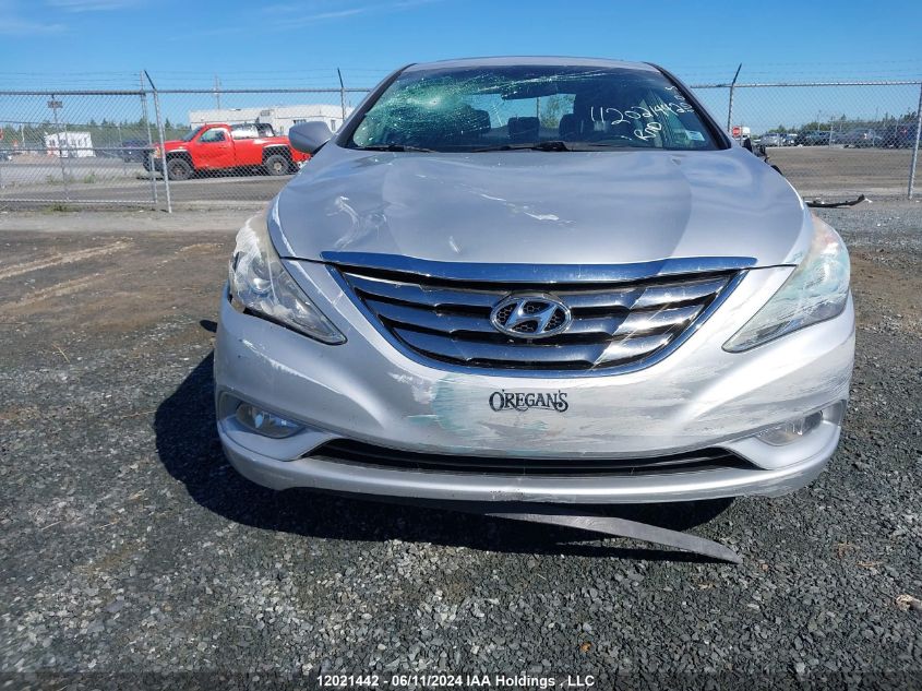 2013 Hyundai Sonata Gls VIN: 5NPEB4AC6DH509986 Lot: 12021442
