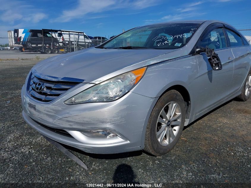 2013 Hyundai Sonata Gls VIN: 5NPEB4AC6DH509986 Lot: 12021442