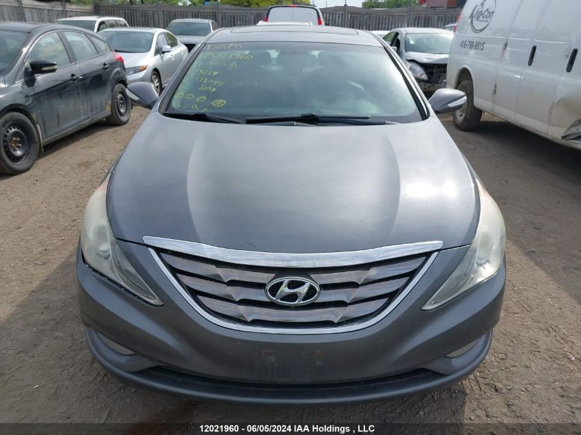 2011 Hyundai Sonata 2.0T Limited VIN: 5NPEC4AB4BH173045 Lot: 12021960