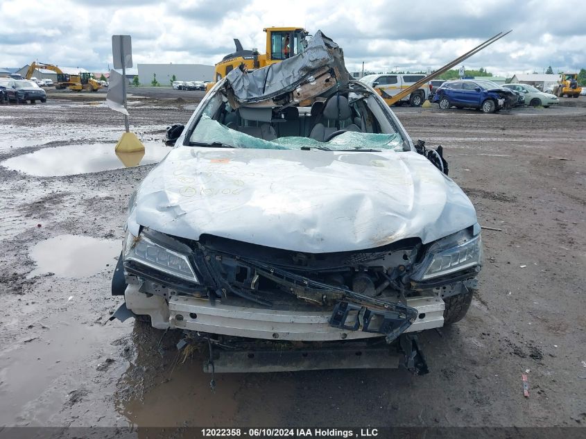 2017 Acura Tlx Tech VIN: 19UUB1F59HA800503 Lot: 12022358