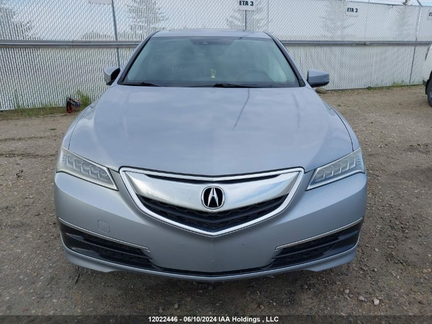 2015 Acura Tlx VIN: 19UUB3F53FA801364 Lot: 12022446