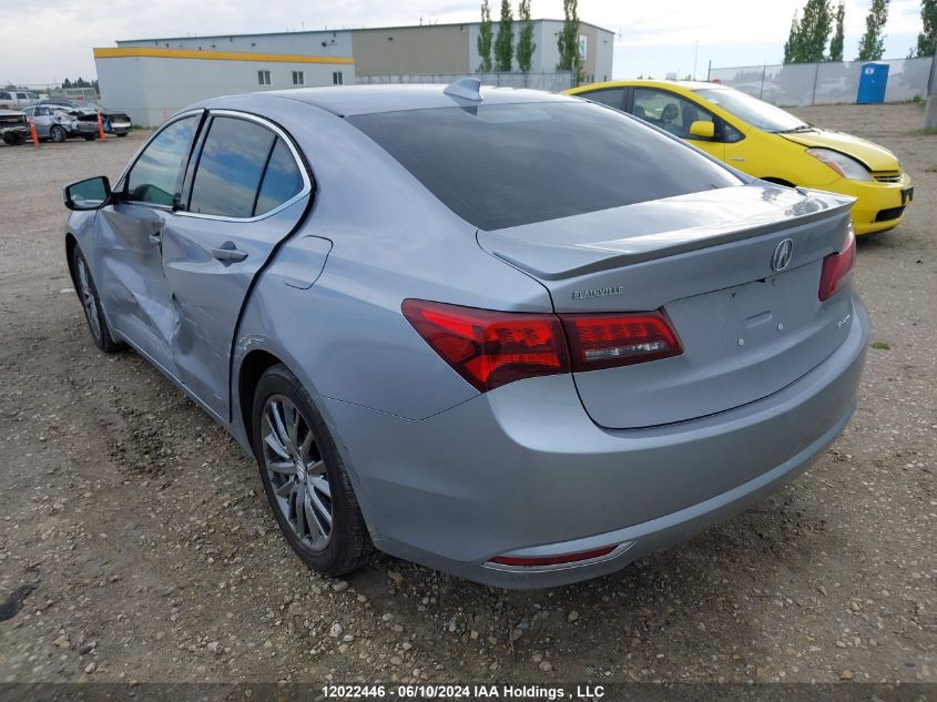 2015 Acura Tlx VIN: 19UUB3F53FA801364 Lot: 12022446