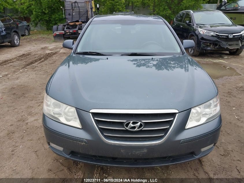 2010 Hyundai Sonata Gls VIN: 5NPET4AC6AH633880 Lot: 12023711