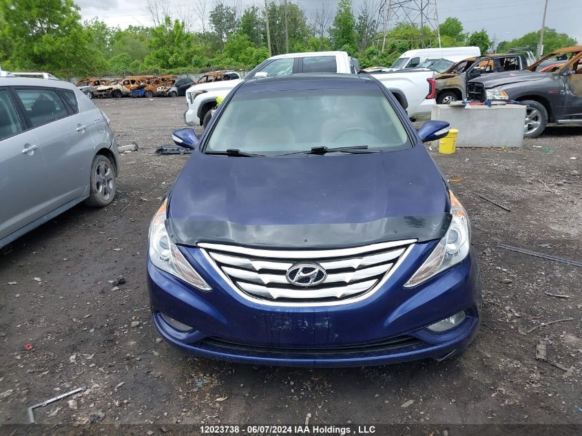 2011 Hyundai Sonata Se/Limited VIN: 5NPEC4AC5BH048967 Lot: 12023738