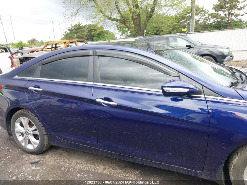 2011 Hyundai Sonata Se/Limited VIN: 5NPEC4AC5BH048967 Lot: 12023738