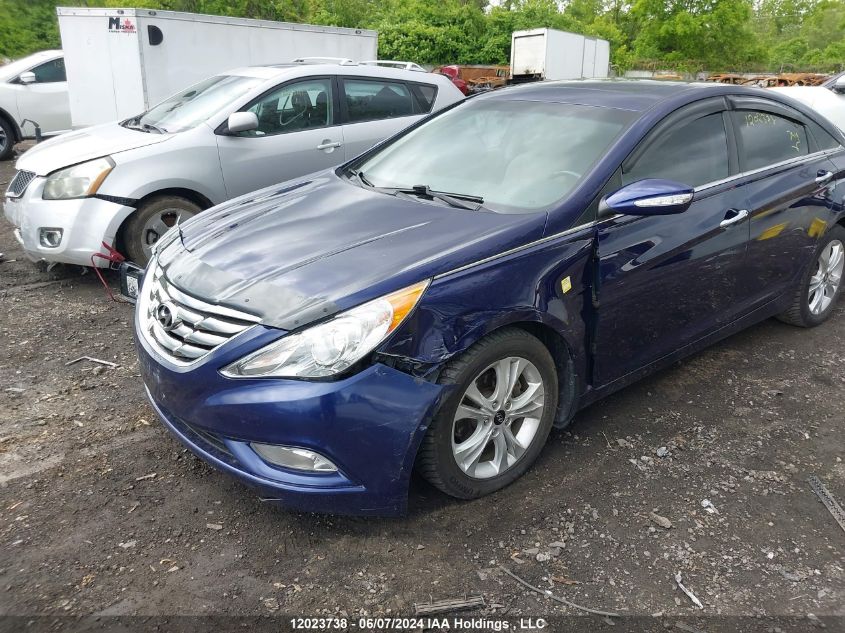 2011 Hyundai Sonata Se/Limited VIN: 5NPEC4AC5BH048967 Lot: 12023738