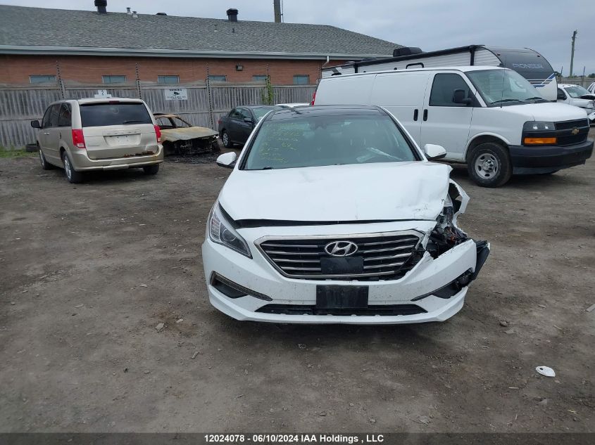 2016 Hyundai Sonata Sport/Limited VIN: 5NPE34AF4GH394428 Lot: 12024078