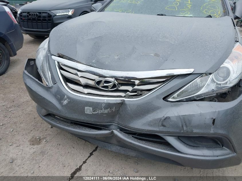 2013 Hyundai Sonata Gls VIN: 5NPEB4AC3DH581065 Lot: 12024111