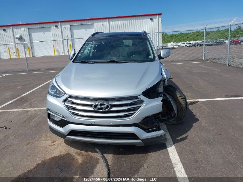 2018 Hyundai Santa Fe Sport 2.0T Se VIN: 5XYZUDLA6JG559118 Lot: 12024456