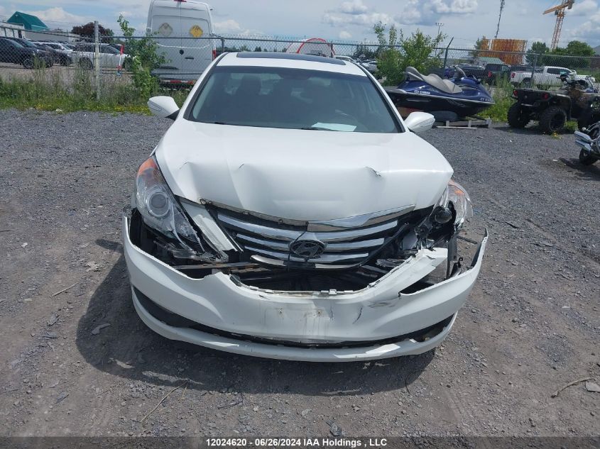5NPEB4AC2EH828822 2014 Hyundai Sonata