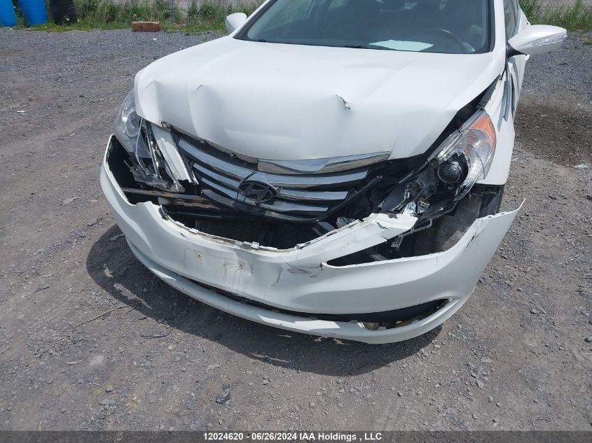 5NPEB4AC2EH828822 2014 Hyundai Sonata