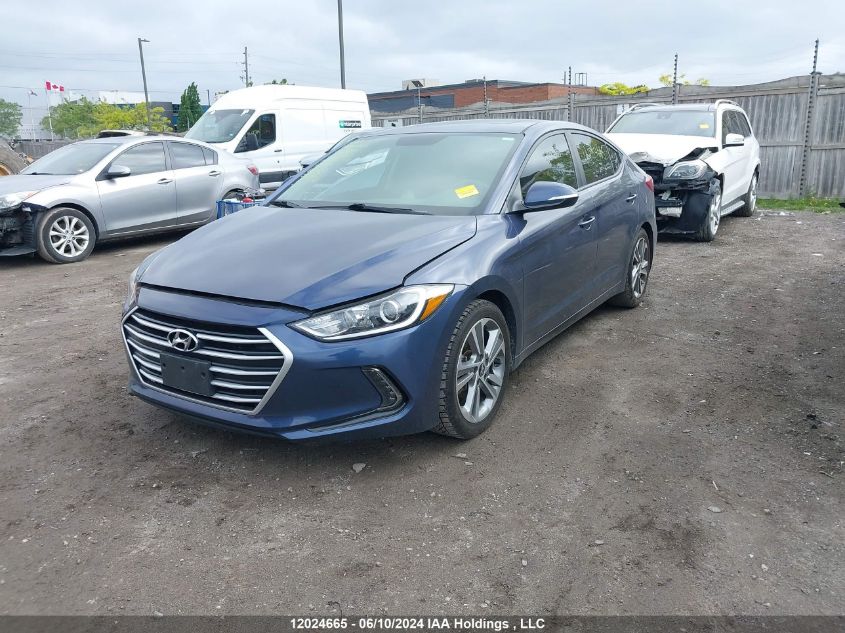 2017 Hyundai Elantra Se/Value/Limited VIN: KMHD84LF8HU254783 Lot: 12024665