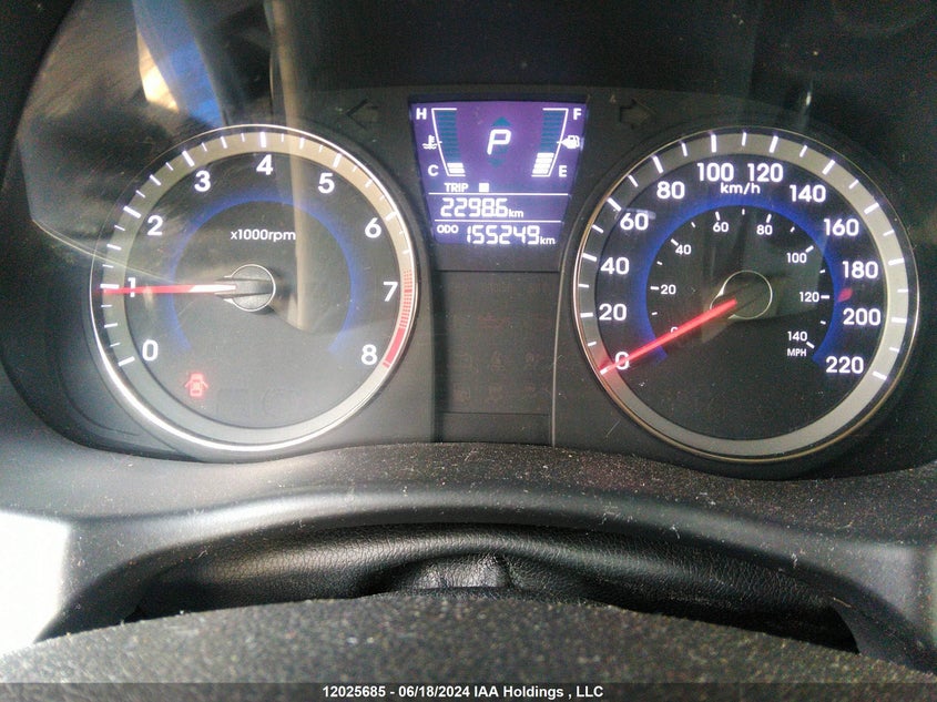 2012 Hyundai Accent VIN: KMHCT5AE1CU043251 Lot: 12025685