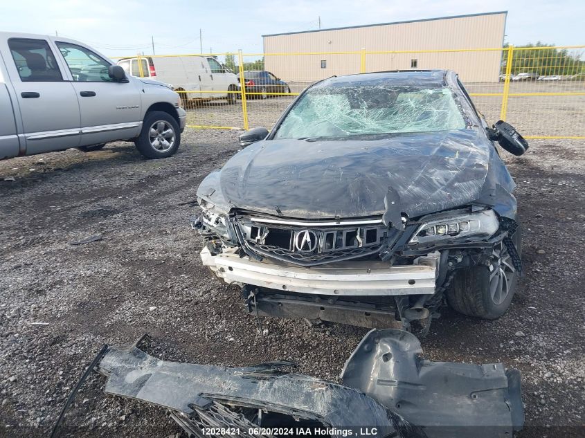 2015 Acura Tlx VIN: 19UUB3F56FA801780 Lot: 12028421