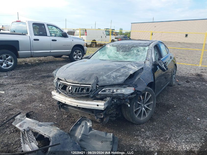 2015 Acura Tlx VIN: 19UUB3F56FA801780 Lot: 12028421