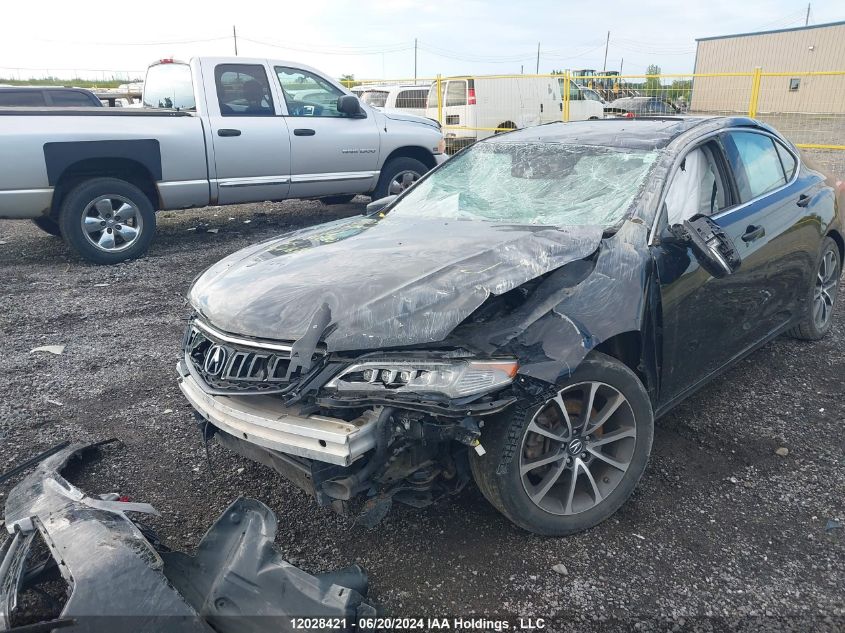 2015 Acura Tlx VIN: 19UUB3F56FA801780 Lot: 12028421