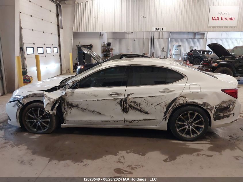 19UUB3F36HA801506 2017 Acura Tlx