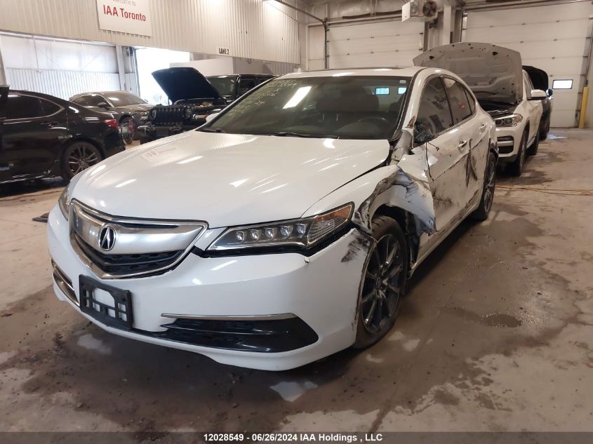 2017 Acura Tlx VIN: 19UUB3F36HA801506 Lot: 12028549